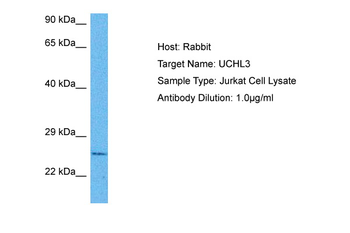 UCHL3 Rabbit Polyclonal Antibody