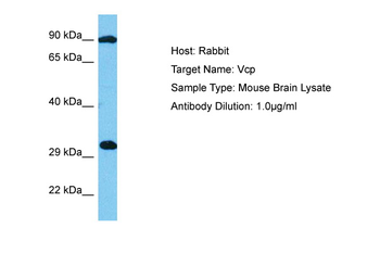 VCP Rabbit Polyclonal Antibody