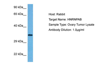 HNRNPAB Rabbit Polyclonal Antibody