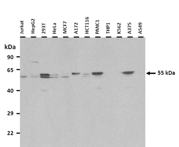 MDM2 Rabbit Polyclonal Antibody