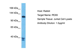 PEX6 Rabbit Polyclonal Antibody