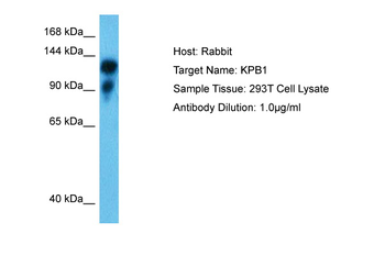 PHKA1 Rabbit Polyclonal Antibody