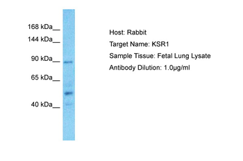 KSR1 Rabbit Polyclonal Antibody