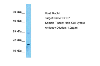 POP7 Rabbit Polyclonal Antibody