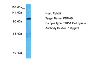 KDM4B Rabbit Polyclonal Antibody