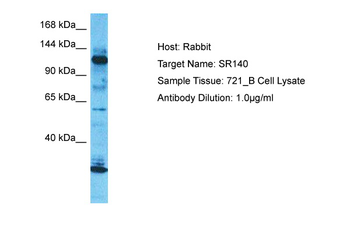 U2SURP Rabbit Polyclonal Antibody
