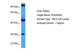 PLEKHG6 Rabbit Polyclonal Antibody