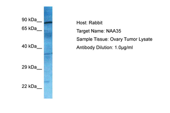 NAA35 Rabbit Polyclonal Antibody