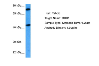 GCC1 Rabbit Polyclonal Antibody