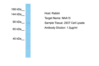 NAA15 Rabbit Polyclonal Antibody