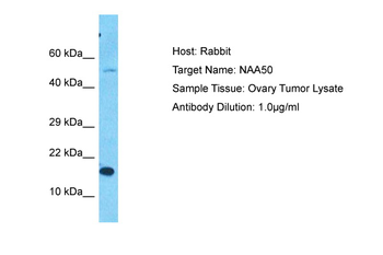 NAA50 Rabbit Polyclonal Antibody