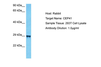 CEP41 Rabbit Polyclonal Antibody