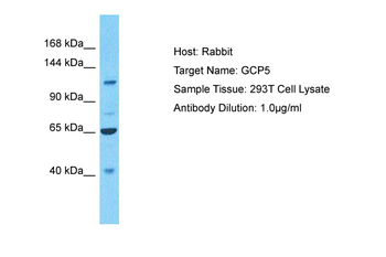 TUBGCP5 Rabbit Polyclonal Antibody