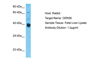 CERS6 Rabbit Polyclonal Antibody