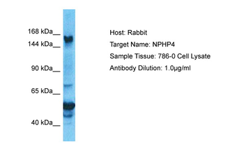 NPHP4 Rabbit Polyclonal Antibody