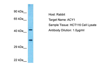 ACY1 Rabbit Polyclonal Antibody