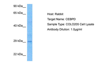 CEBPD Rabbit Polyclonal Antibody