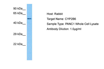 CYP2B6 Rabbit Polyclonal Antibody