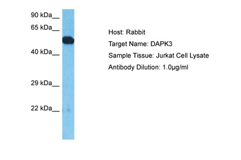 DAPK3 Rabbit Polyclonal Antibody