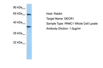 DECR1 Rabbit Polyclonal Antibody
