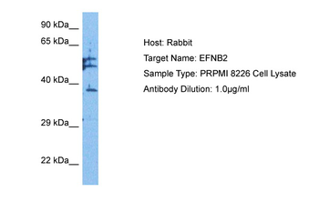 EFNB2 Rabbit Polyclonal Antibody