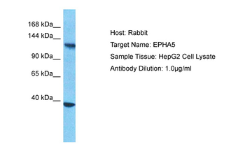EPHA5 Rabbit Polyclonal Antibody