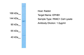 EPHB1 Rabbit Polyclonal Antibody