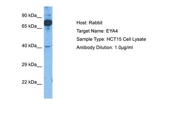 EYA4 Rabbit Polyclonal Antibody