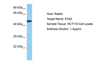 EYA2 Rabbit Polyclonal Antibody