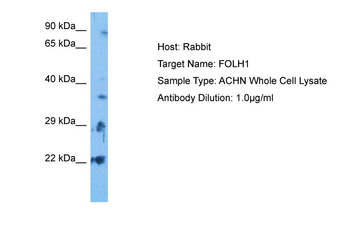 FOLH1 Rabbit Polyclonal Antibody