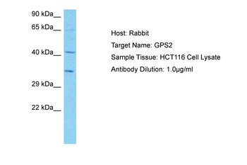 GPS2 Rabbit Polyclonal Antibody