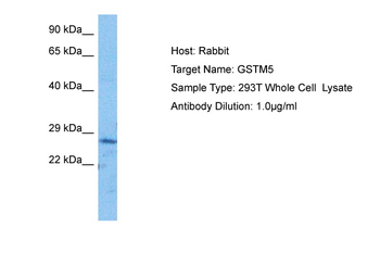 GSTM5 Rabbit Polyclonal Antibody
