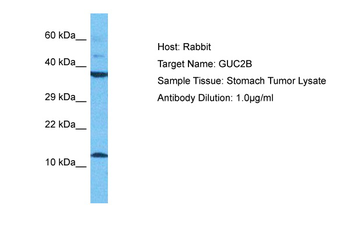 GUCA2B Rabbit Polyclonal Antibody