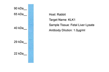 KLK1 Rabbit Polyclonal Antibody
