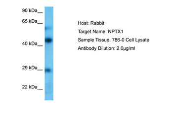 NPTX1 Rabbit Polyclonal Antibody
