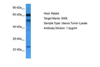 SIX6 Rabbit Polyclonal Antibody