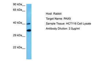 PAX9 Rabbit Polyclonal Antibody