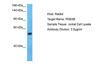 PDE6A Rabbit Polyclonal Antibody