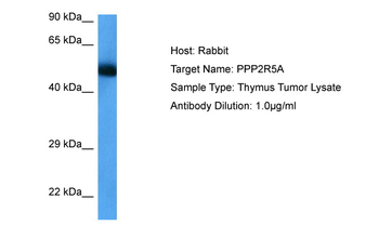 PPP2R5A Rabbit Polyclonal Antibody