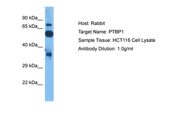 PTBP1 Rabbit Polyclonal Antibody