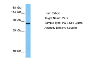 PYGM Rabbit Polyclonal Antibody