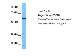 FSCN1 Rabbit Polyclonal Antibody