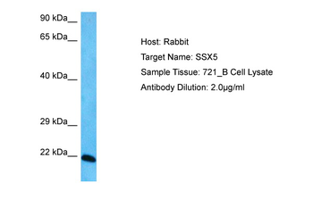 SSX5 Rabbit Polyclonal Antibody