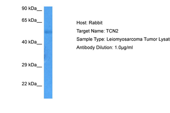 TCN2 Rabbit Polyclonal Antibody