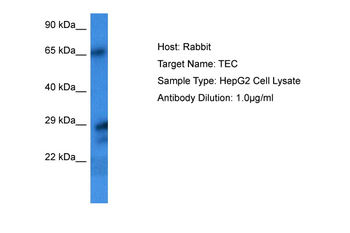 TEC Rabbit Polyclonal Antibody