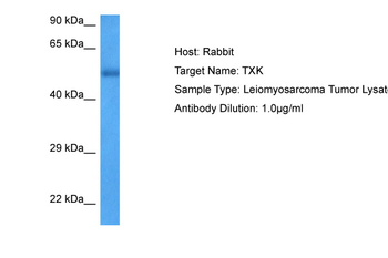 TXK Rabbit Polyclonal Antibody