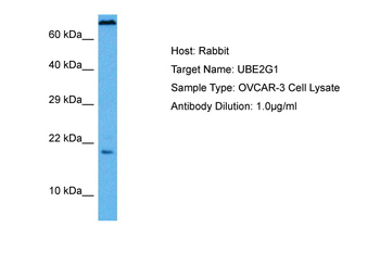 UBE2G1 Rabbit Polyclonal Antibody