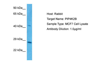 PIP4K2B Rabbit Polyclonal Antibody