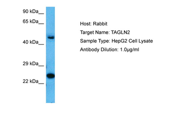 TAGLN2 Rabbit Polyclonal Antibody