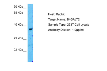 B4GALT2 Rabbit Polyclonal Antibody